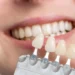 Licówki stomatologiczne - dokonaj właściwego wyboru