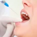 Bezbolesne leczenie stomatologiczne