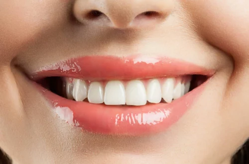 Jak wygląda leczenie próchnicy zębów?