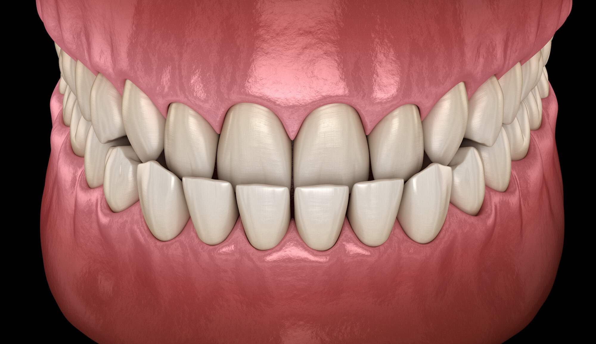 Ortotropia a leczenie wad zgryzu